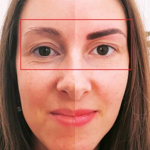 Cara de mujer con antes y despues de microblading malaga