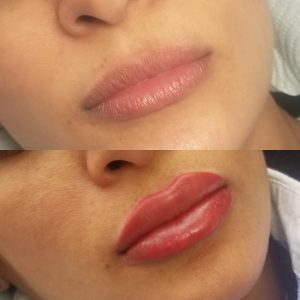 Antes y después de migropigmentación de labios